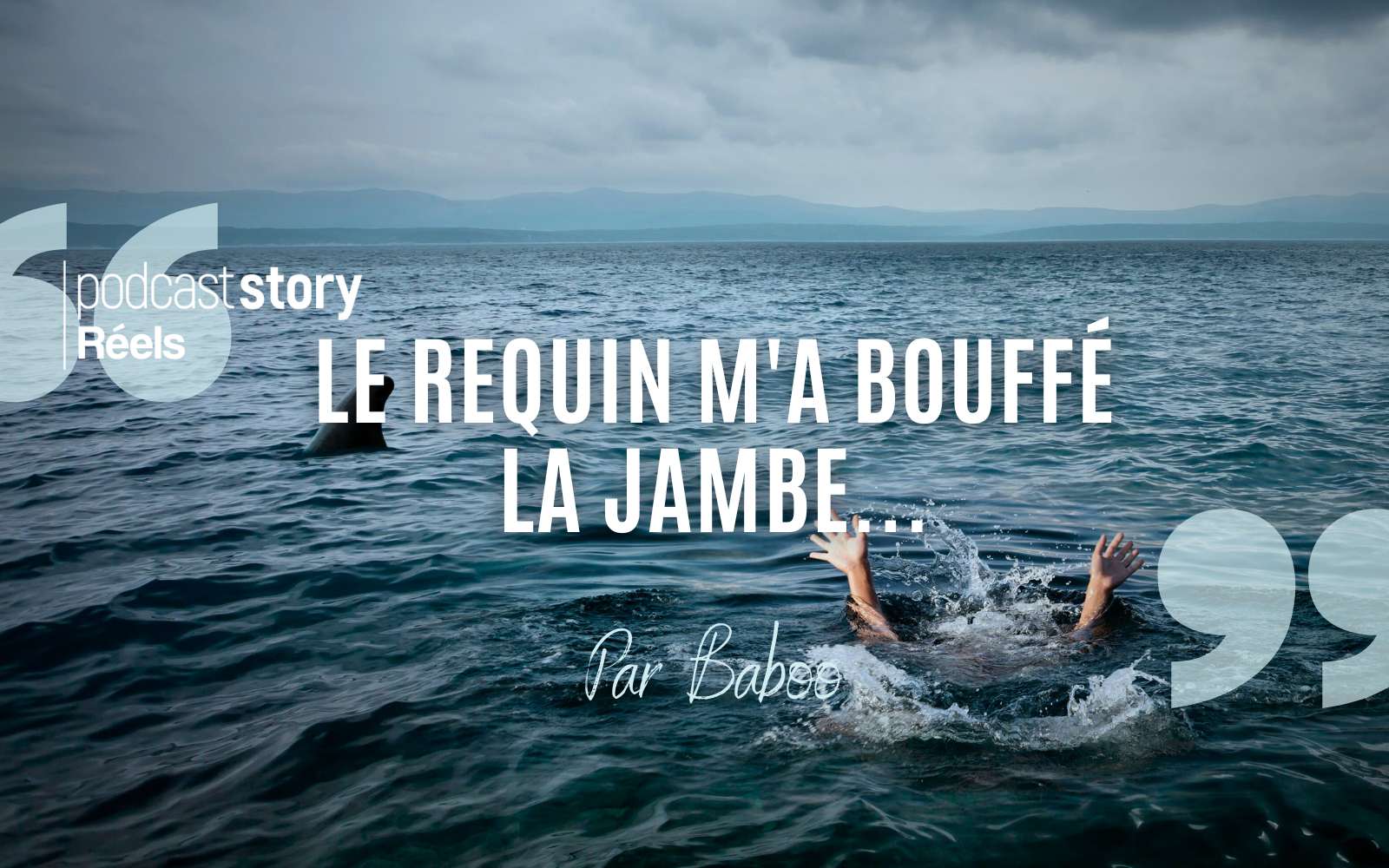 LE REQUIN M’A BOUFFÉ LA JAMBE… – Par Baboo